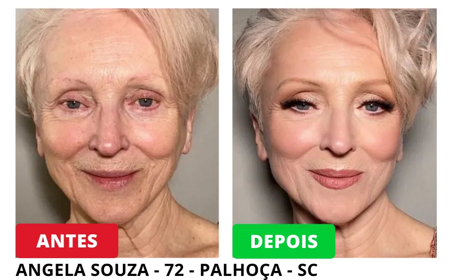 antes de depois